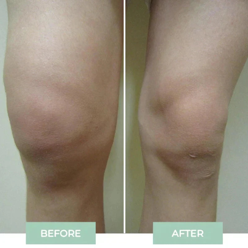 New Kitchen Tool and Gadget 2025 Massage 2025 Trending New Product 2025 New Arrival Tool Device Knee Body Massager Physiotherapy